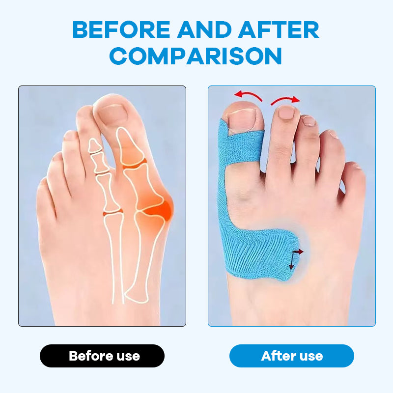 Toe Support Straps for Comfortable, Gentle Foot Relief