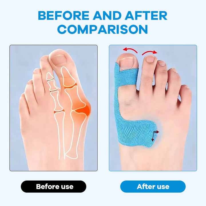Toe Support Straps for Comfortable, Gentle Foot Relief