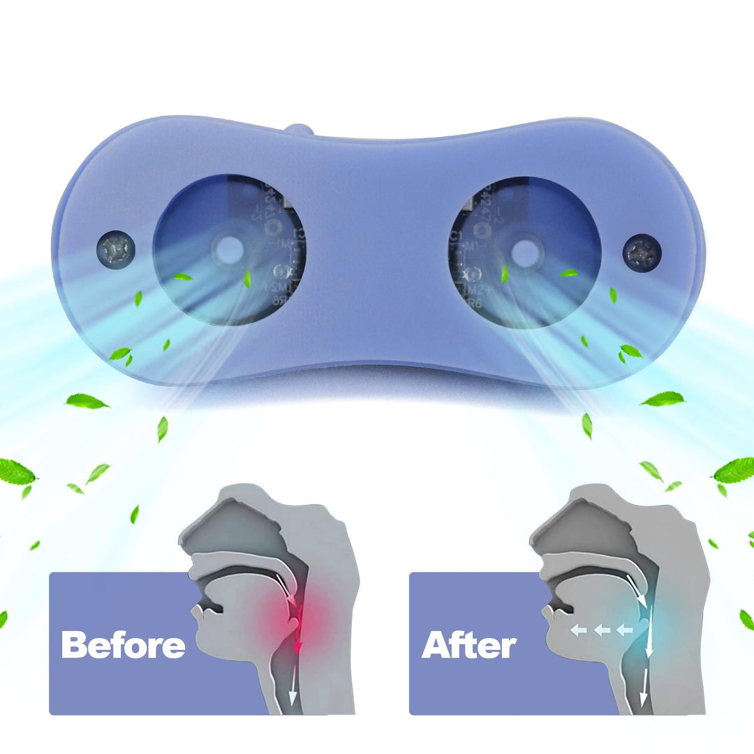 SleepAir Silent Snore Stopper - Small, Cordless &amp; Comfortable Sleep Solution