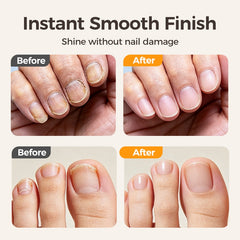 Electric Nail Clipper - 2-in-1 Trimmer &amp; Nail Grinder, Safe for Seniors