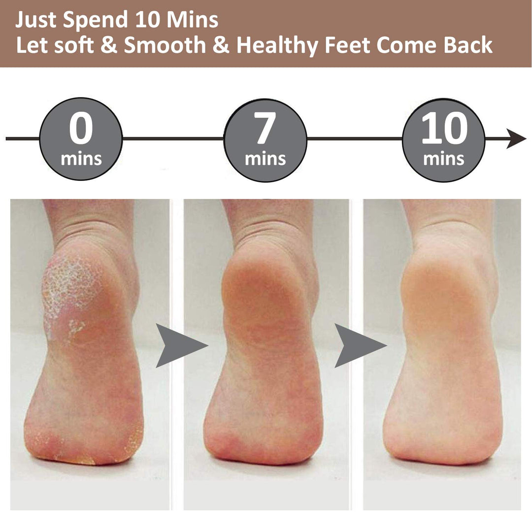 Electric Foot Pedicure Machine - Velloraco