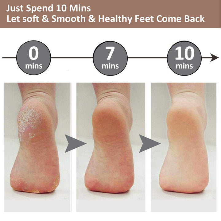 Electric Foot Pedicure Machine - Velloraco